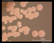 serratia on macconkey: lactose negative